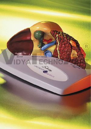 Liver Pathology Model